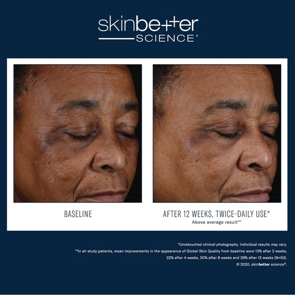 SkinBetter - Mystro - Picture 2 of 3